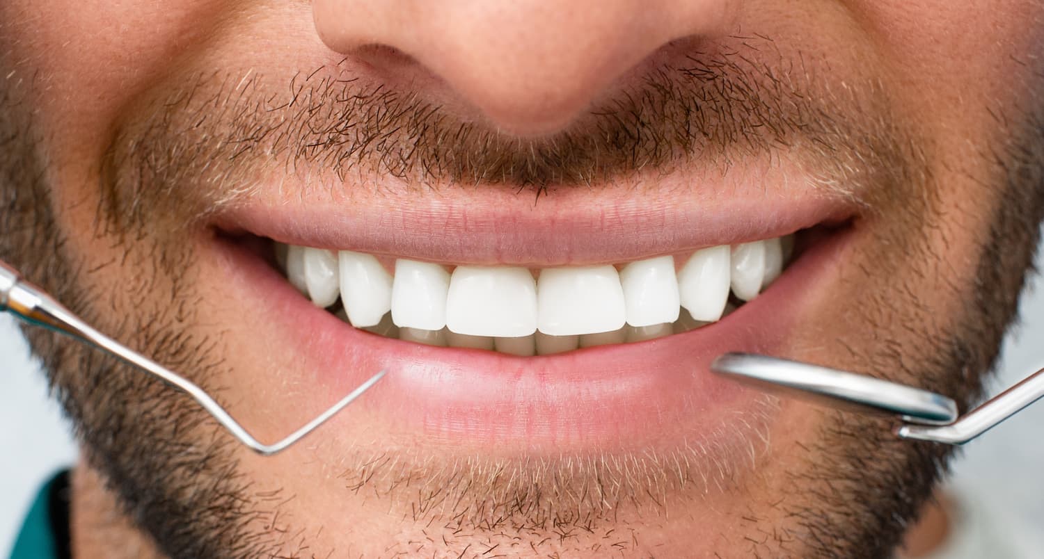 Periodontal treatment in London MyHealthcare Clinic