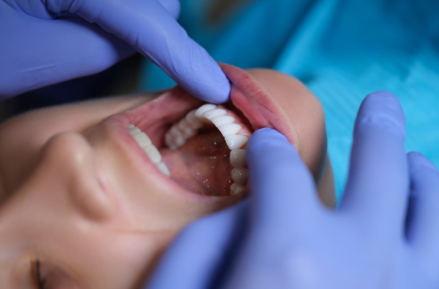 Comfortable Oral Surgery in London