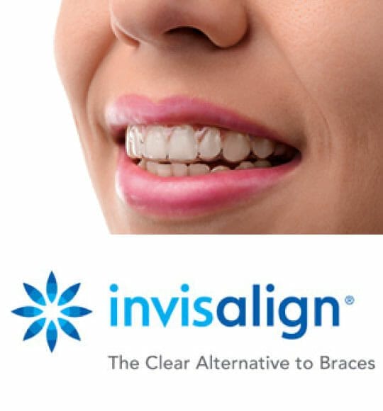 Invisalign | MyHealthcare Clinic